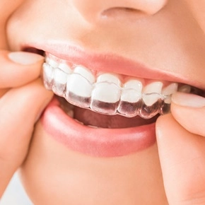 Invisalign en Arturo Soria